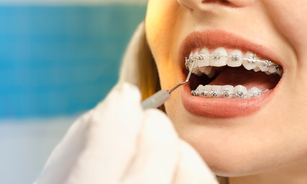 Dentist pointing to tooth on a panoramic X-ray displayed on a computer screen.