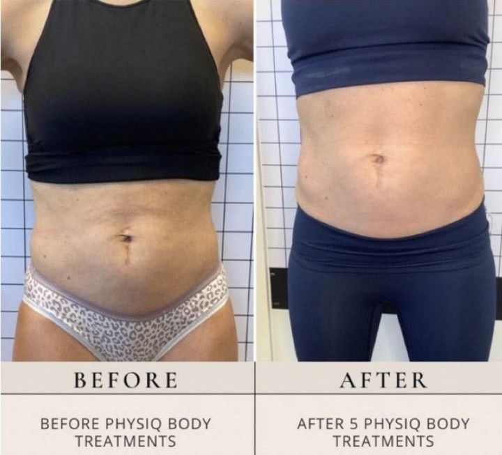 A before and after photo of a woman 's stomach