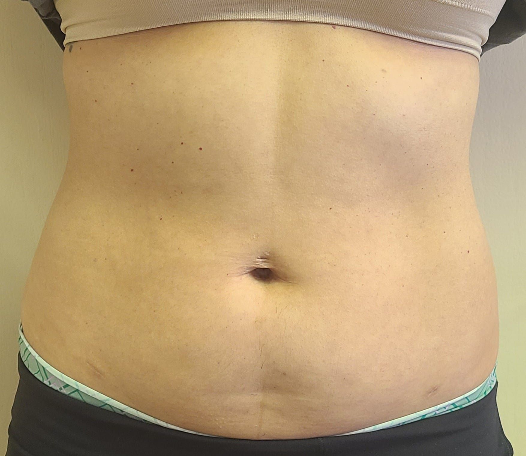 A woman 's stomach is shown in a close up.