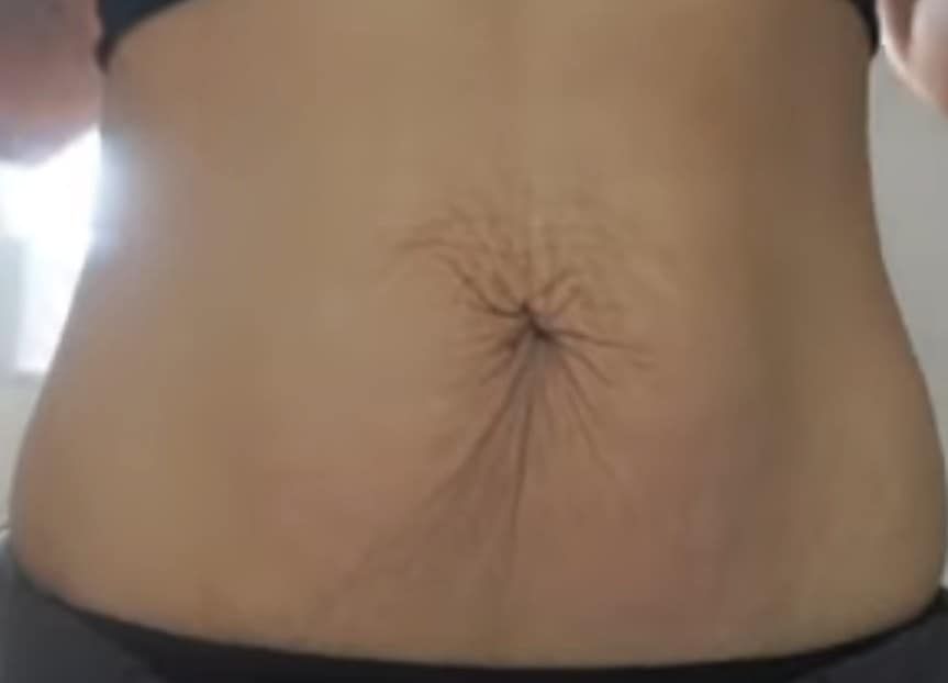 A close up of a woman 's stomach with a spider on it.