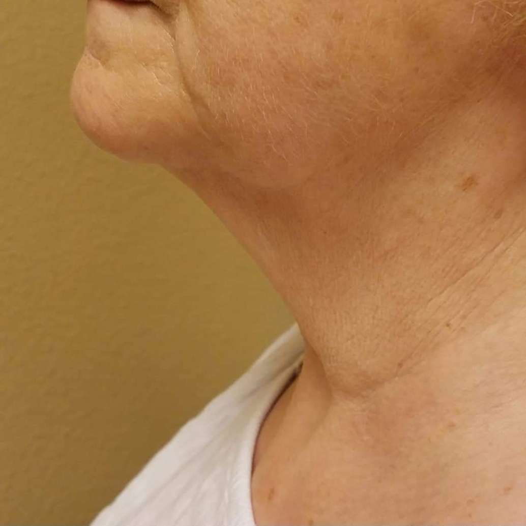 A close up of a woman 's neck and chin.
