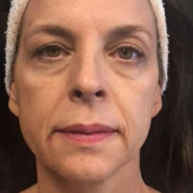 A close up of a woman 's face with a headband on.