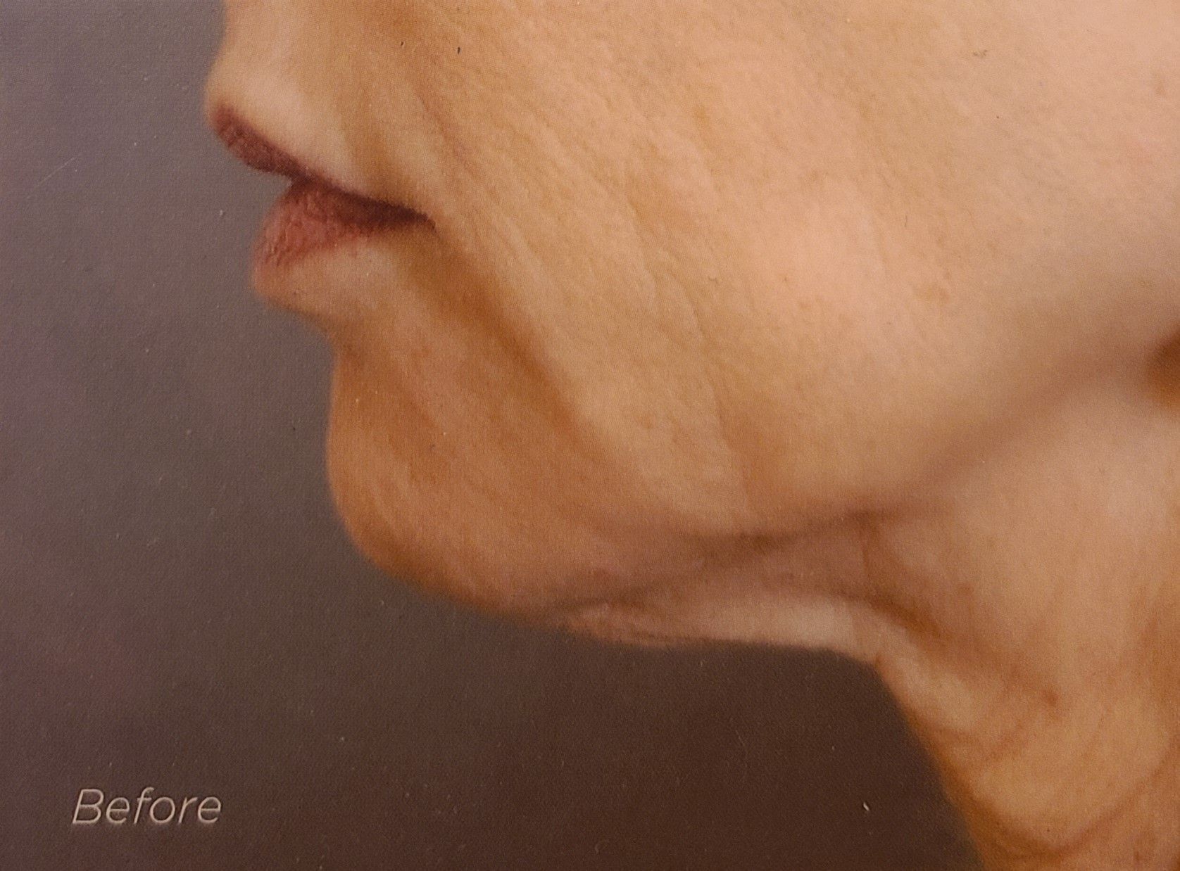 A close up of a woman 's face with wrinkles on it.