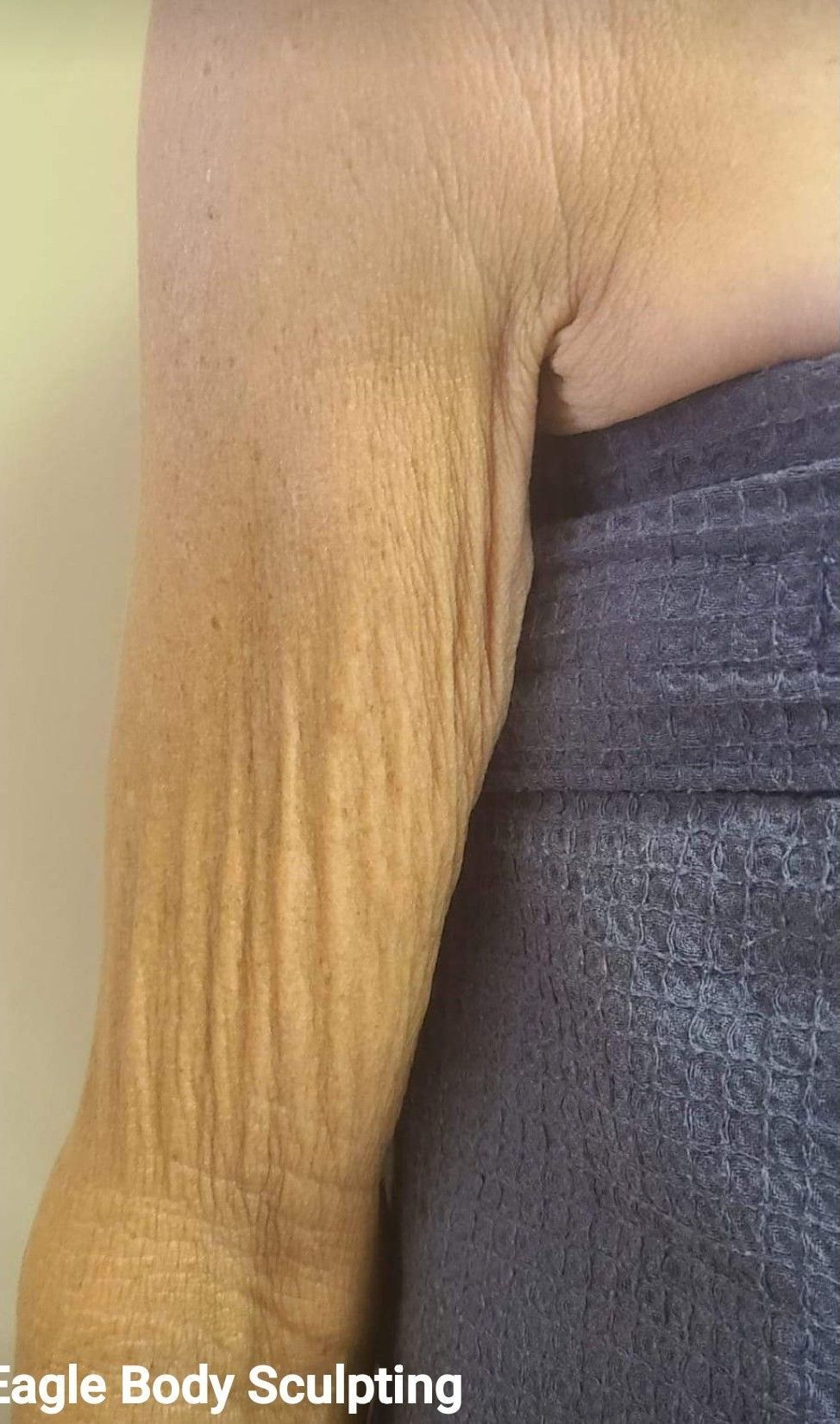 A close up of a woman 's arm with wrinkles.