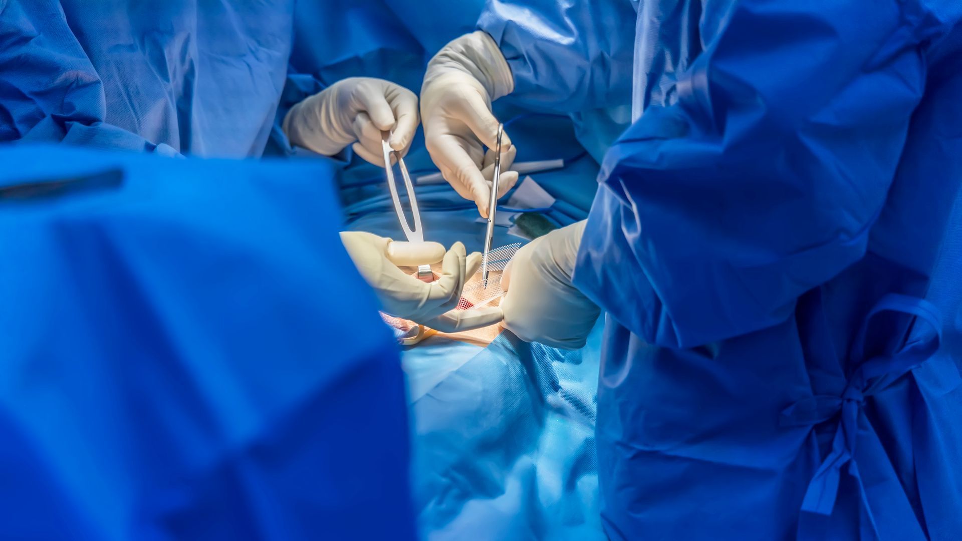 Best Hernia Surgeons in Phoenix Arizona