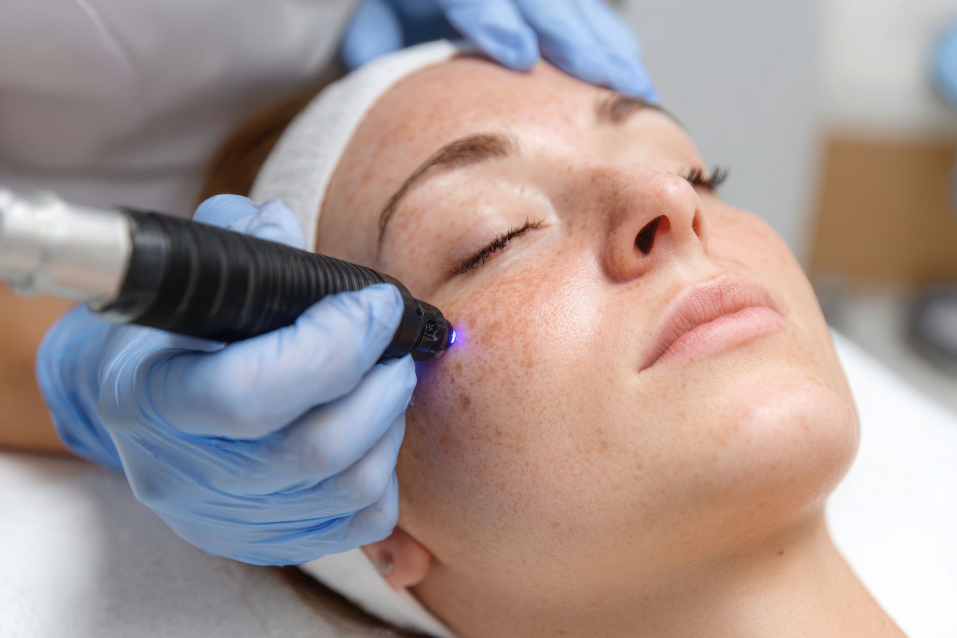 Skin Tag Removal Phoenix