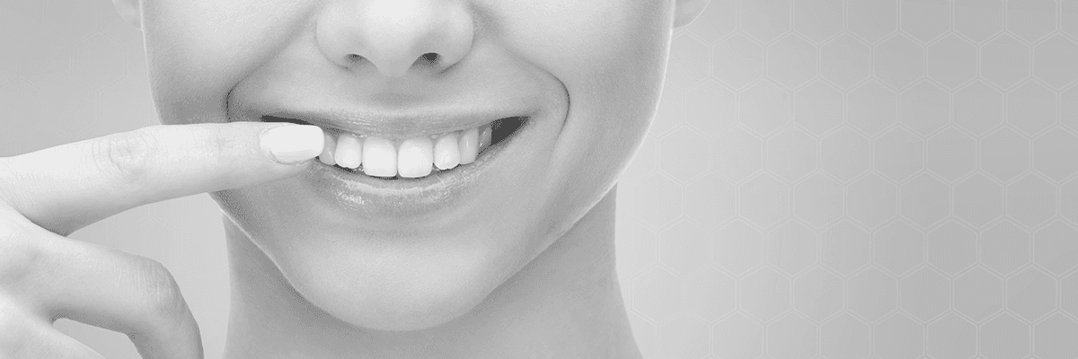 Ein lächelnder Mund, ein Finger zeigt auf die Zähne. Schwarz-weiß.