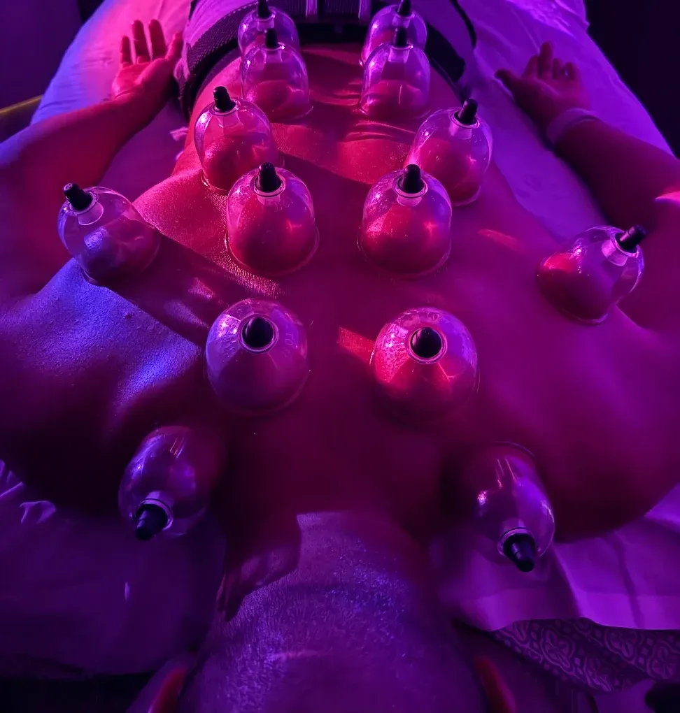 Person receiving cupping therapy on their back, with red and purple lighting.