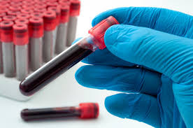 Hand Holding Blood Samples — Nashville, TN — NGH School of Health Sciences