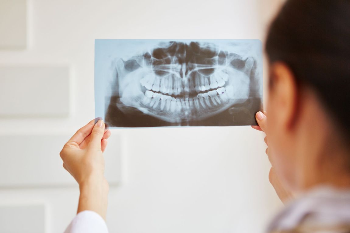 radiografia odontoiatrica
