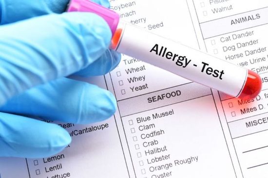 test allergologico