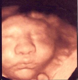 ULTRASONIDO DIAGNÓSTICO DE HIDALGO