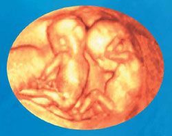 ULTRASONIDO DIAGNÓSTICO DE HIDALGO