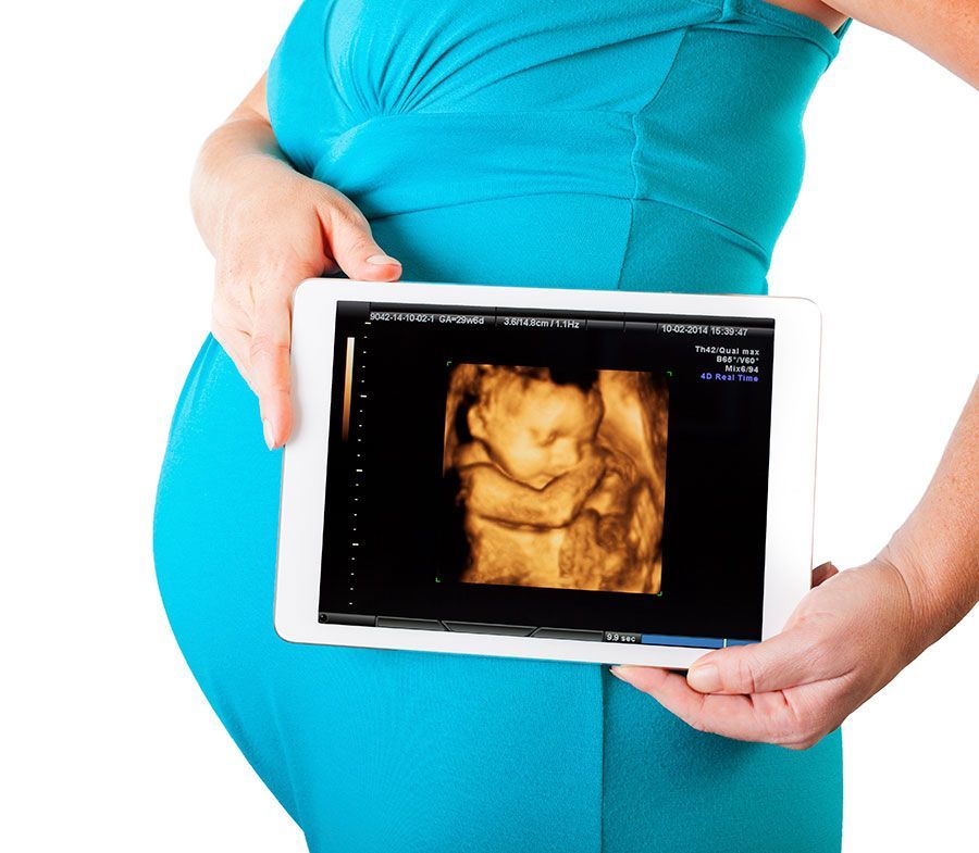 ULTRASONIDO DIAGNÓSTICO DE HIDALGO