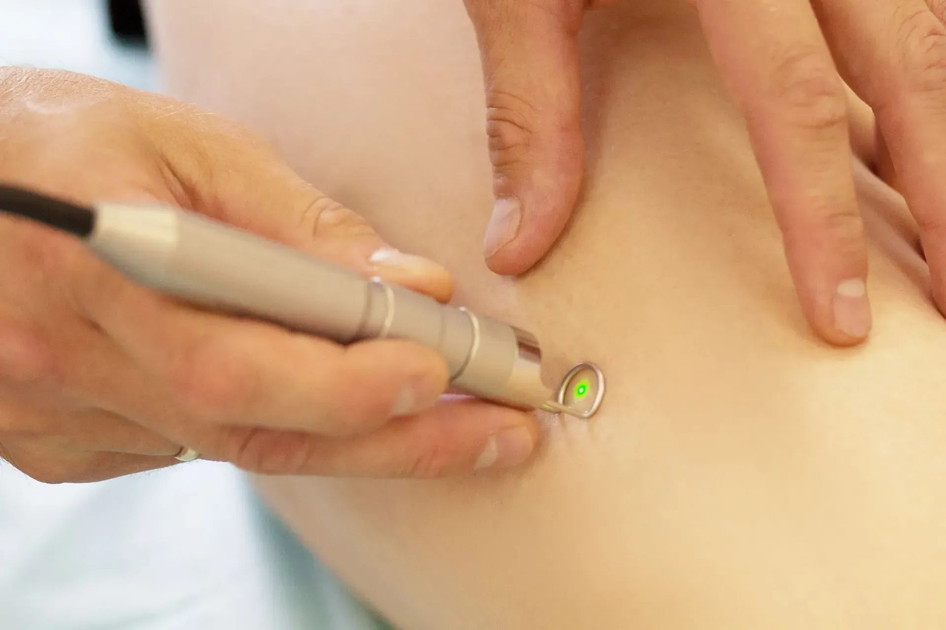 A hand uses a laser device on skin near a small green-lit target area.