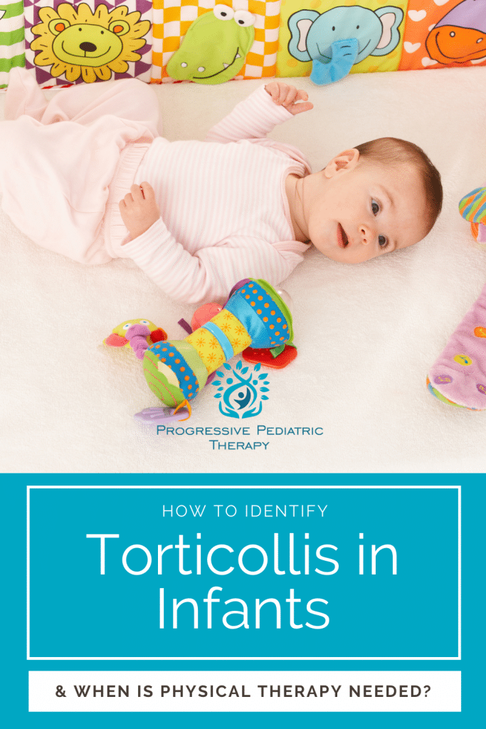 A baby with torticollis is laying on the floor