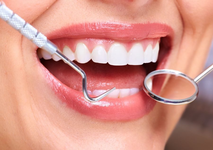 Sbiancamento dei denti