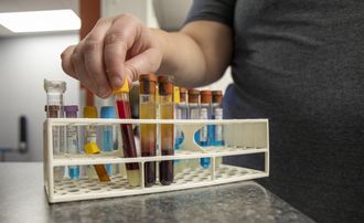 Hand placing a test tube into a rack of colorful lab samples