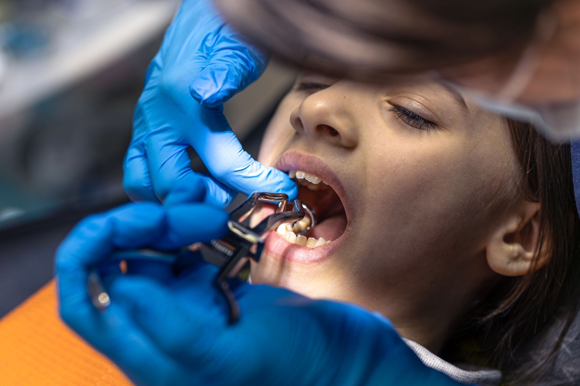 Dentist's hands in blue gloves using tools on a child's open mouth, with eyes closed, in a dental setting.