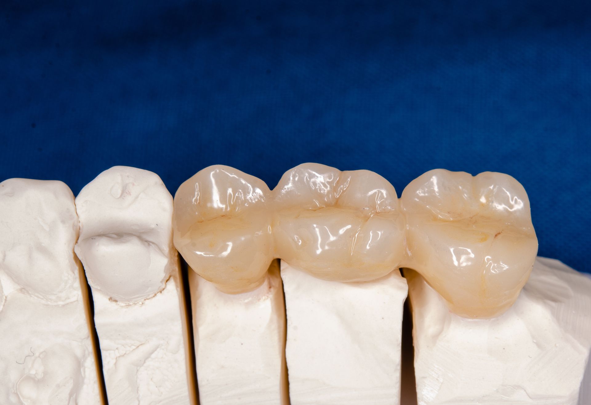 Dentist examining a patient's teeth with tools, the patient wearing protective glasses, indoor setting.