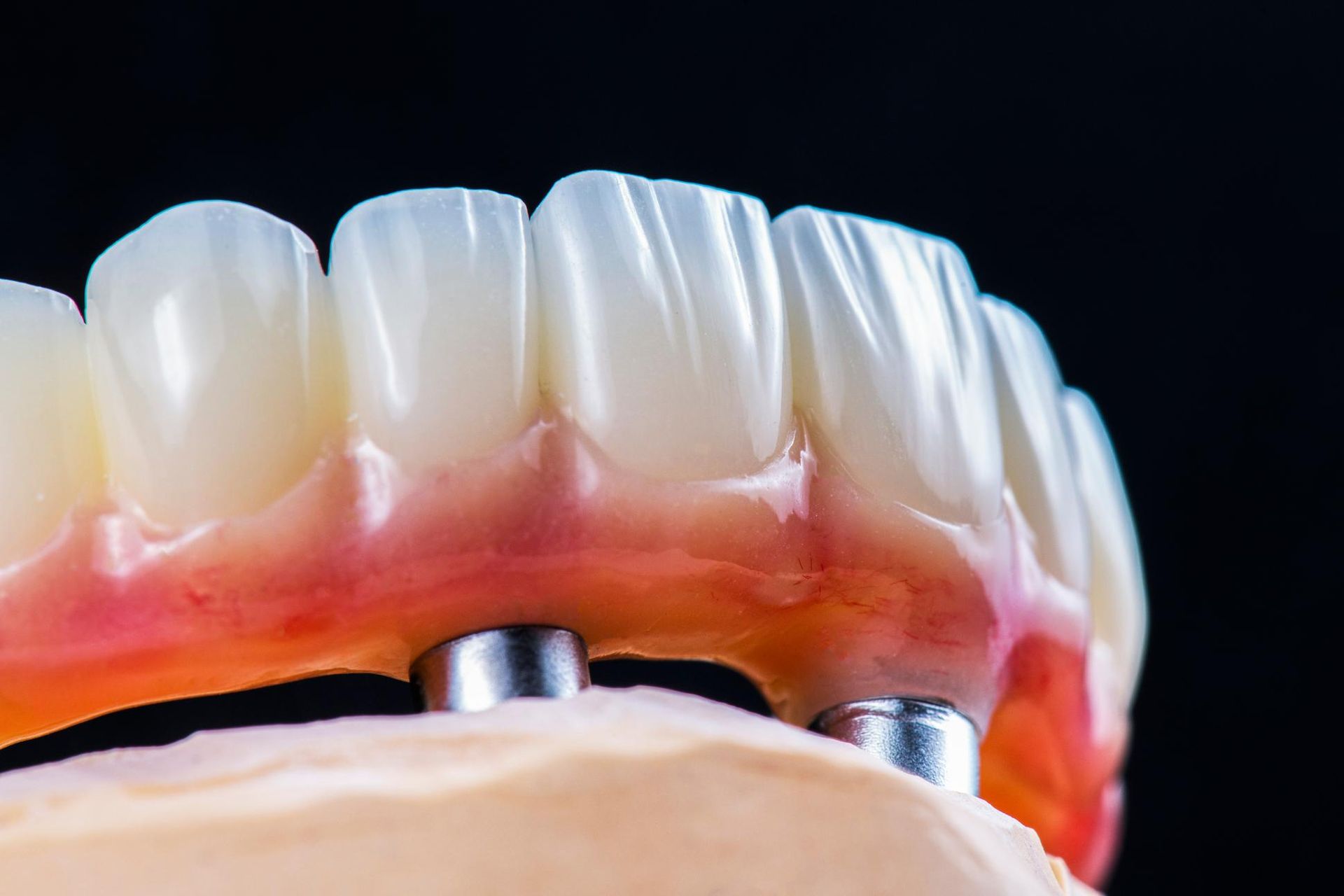 A Woman Is Holding a Clear Retainer in Front of Her Teeth — Advanced Dental Southern Highlands in Moss Vale, NSW