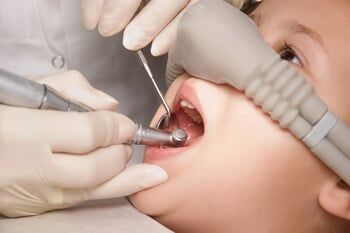 Dental sedation — Professional Dentistry in Salt Lake City,UT