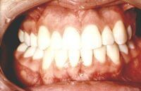 After — Professional Dentistry in Salt Lake City,UT