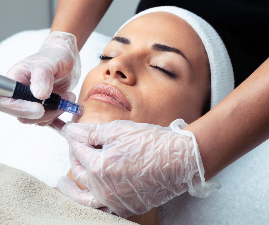 Microneedling | Eye Foundation of Utah