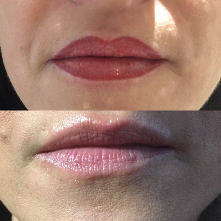 Ein Vorher-Nachher-Foto der Lippen einer Frau mit rotem Lippenstift