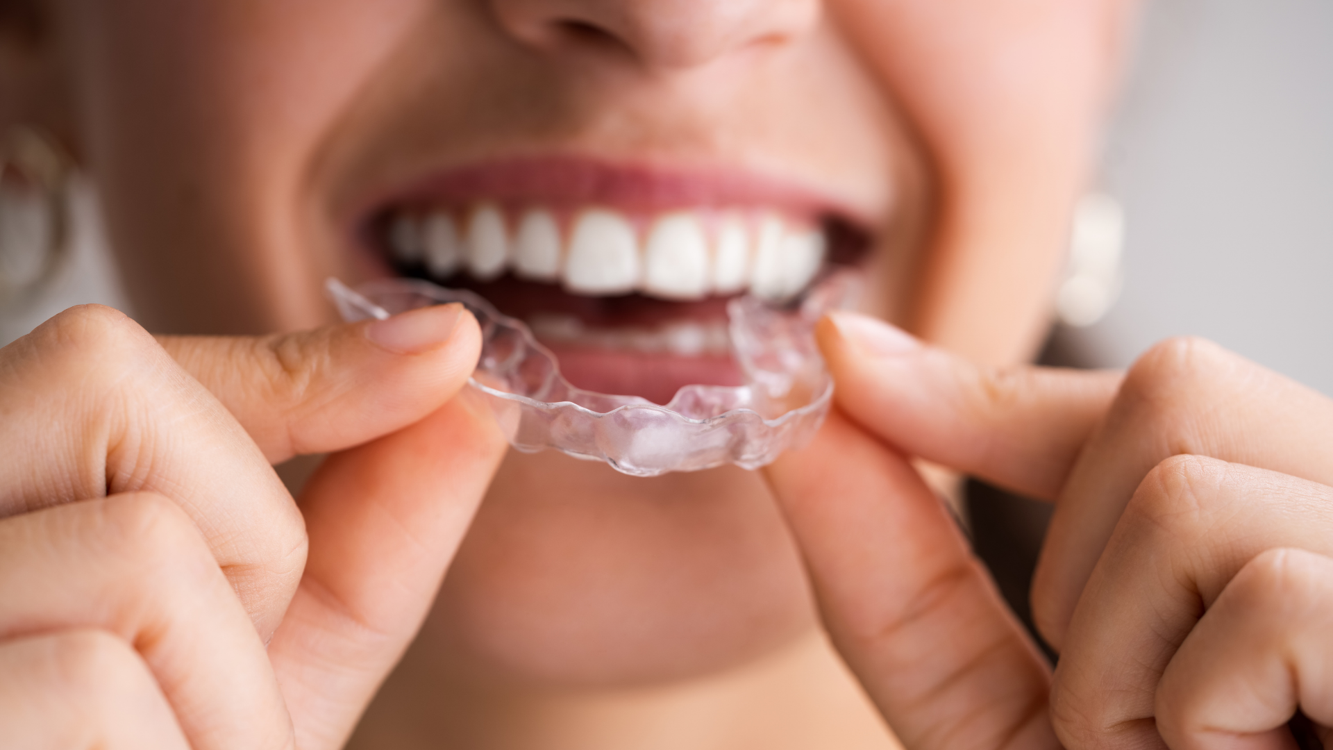 A woman is holding a clear brace in her mouth.