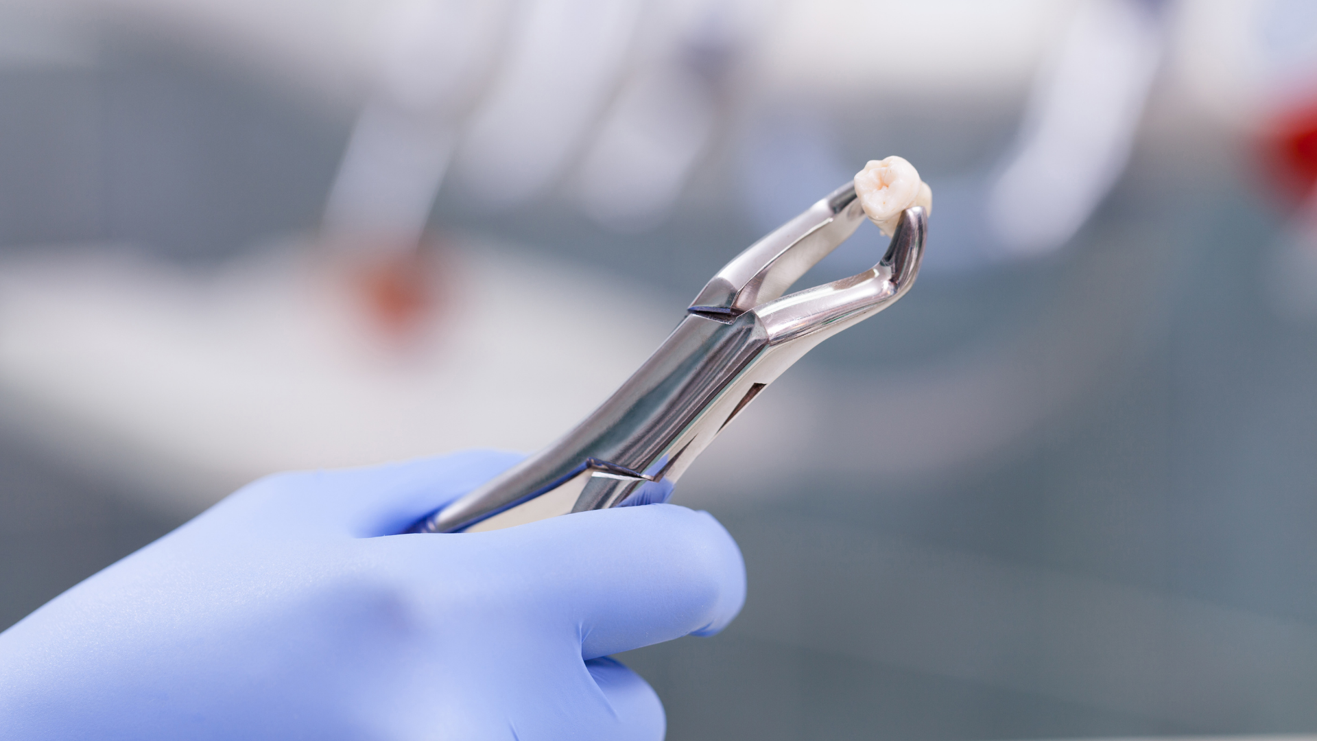 A dentist is holding a pair of dental pliers with a tooth in it.