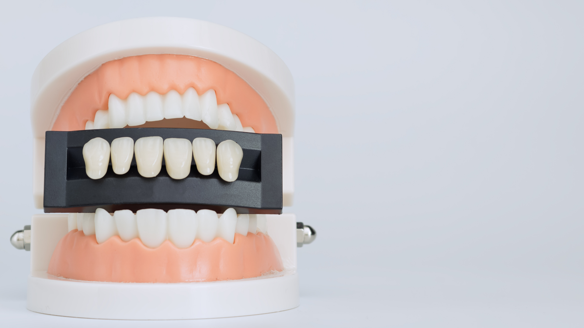 Dental shade guide held in front of a model mouth with teeth