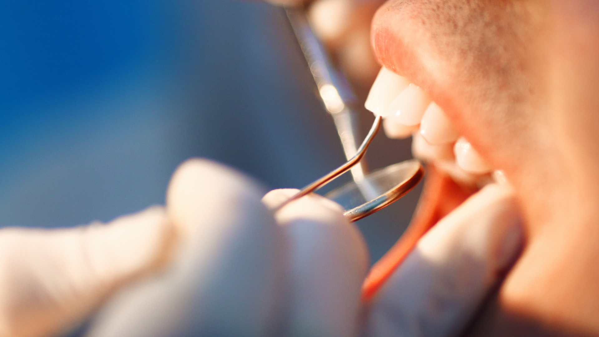 Dentist using tools to examine a patient's teeth during a close-up dental procedure