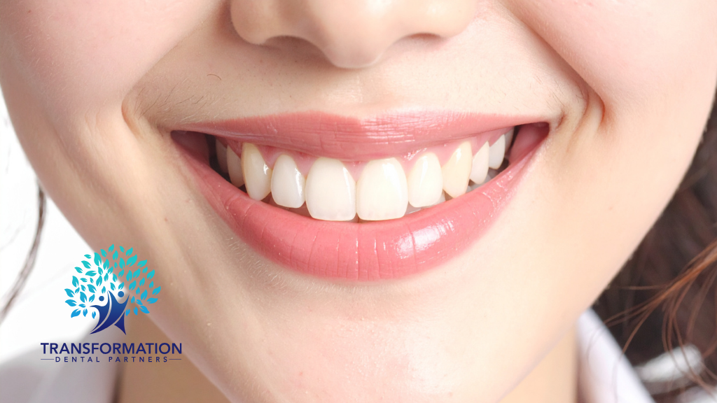 Close-up of a smiling mouth with bright white teeth and pink lips; white shirt collar visible.