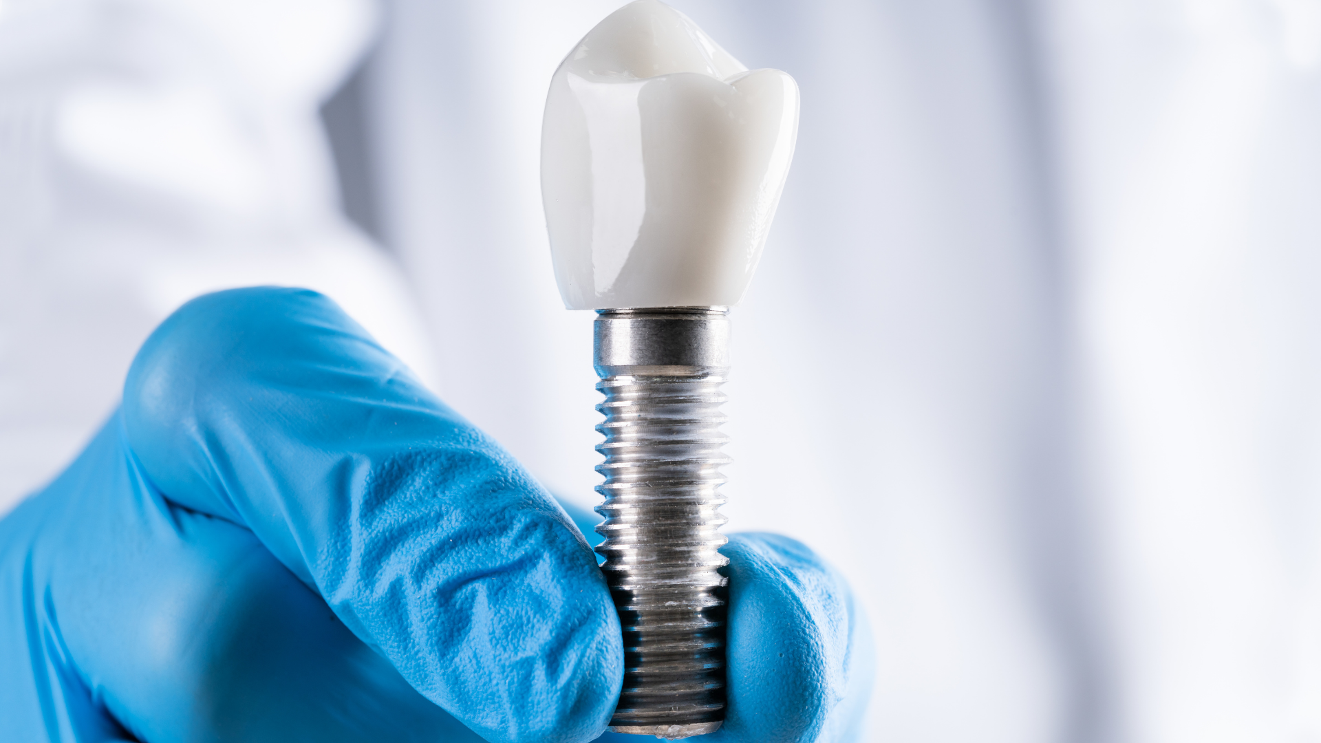 A dentist is holding a dental implant in his hand.