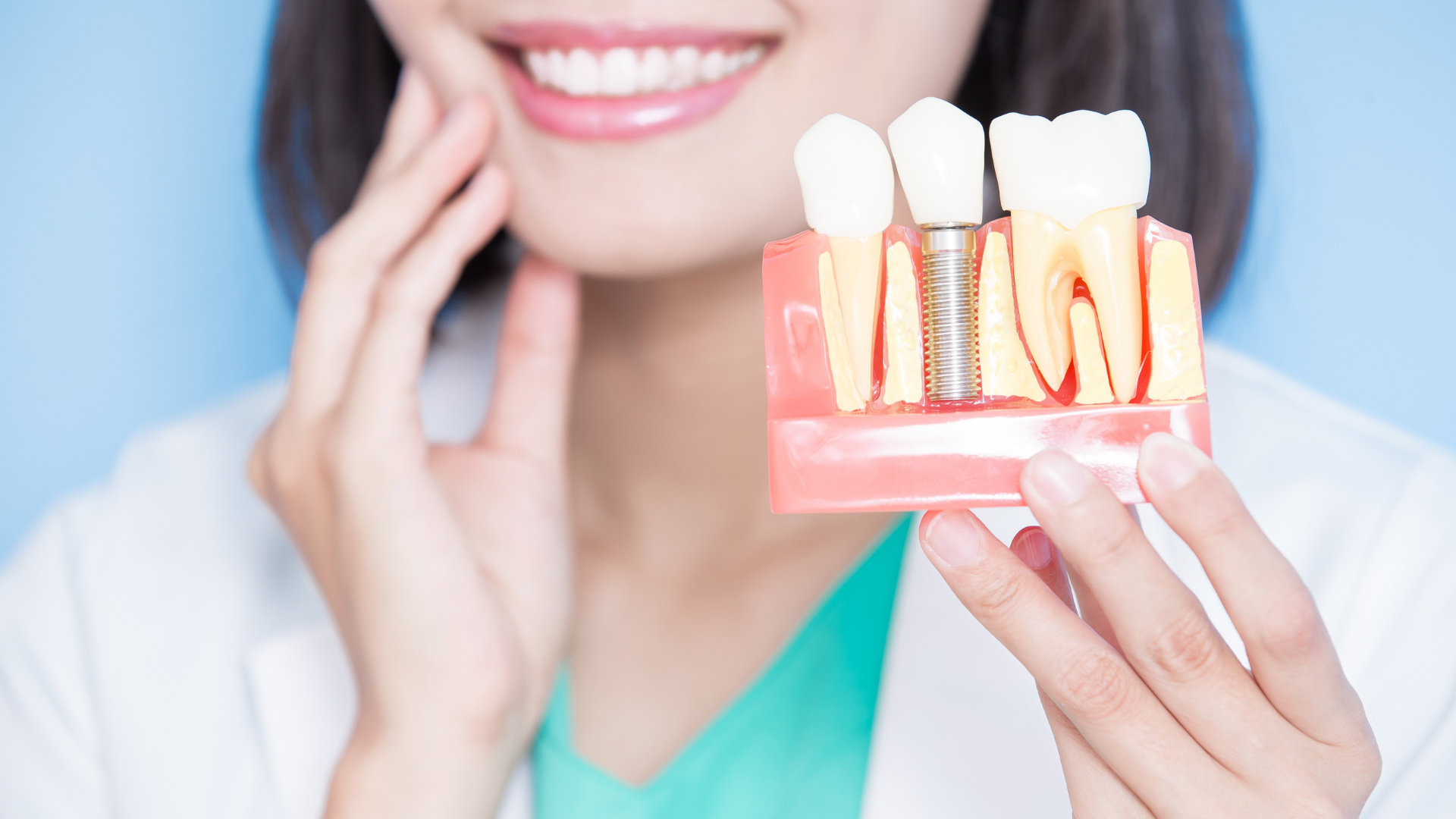 Woman holding a dental model showing a tooth implant, smiling. Blue background, white lab coat.
