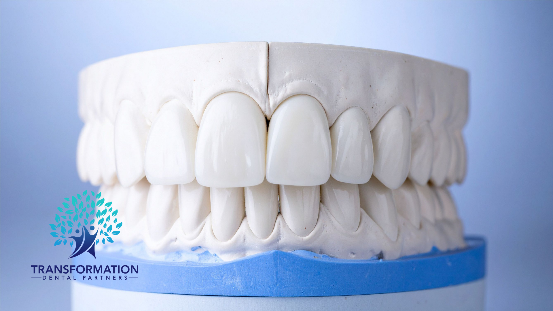 Dental mold with white ceramic teeth on a blue and white base.