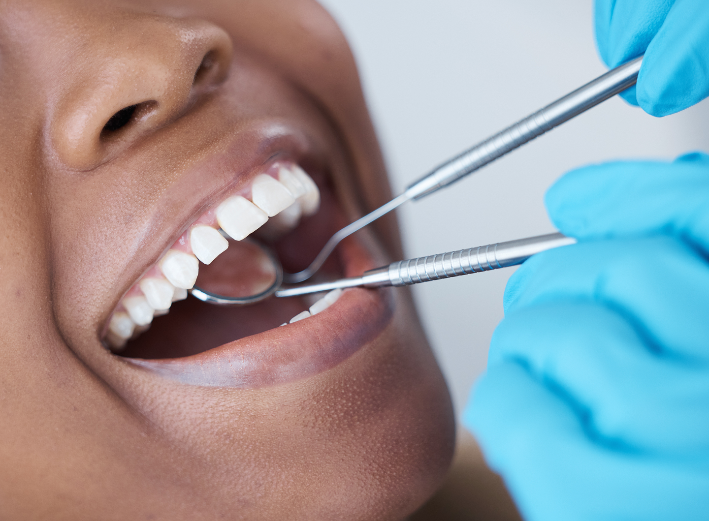 A woman is getting her teeth examined by a dentist.