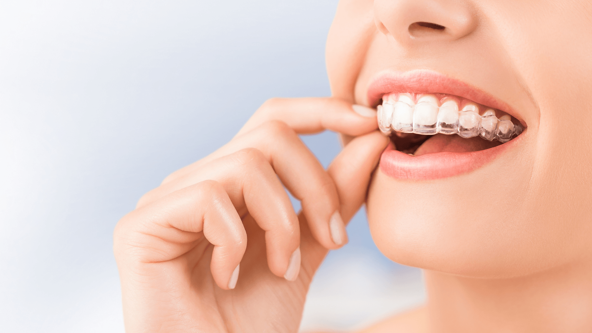 A woman with braces on her teeth is biting her nails.