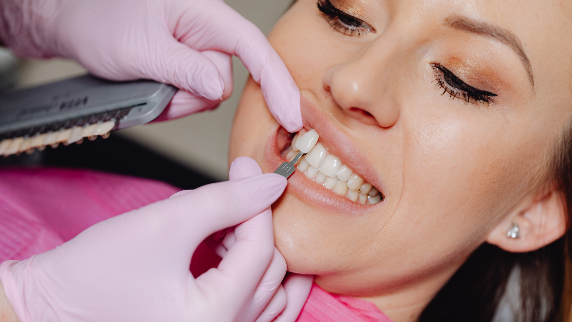 A dentist wearing light purple gloves holds a tooth shade guide against a patient's teeth to match their color.