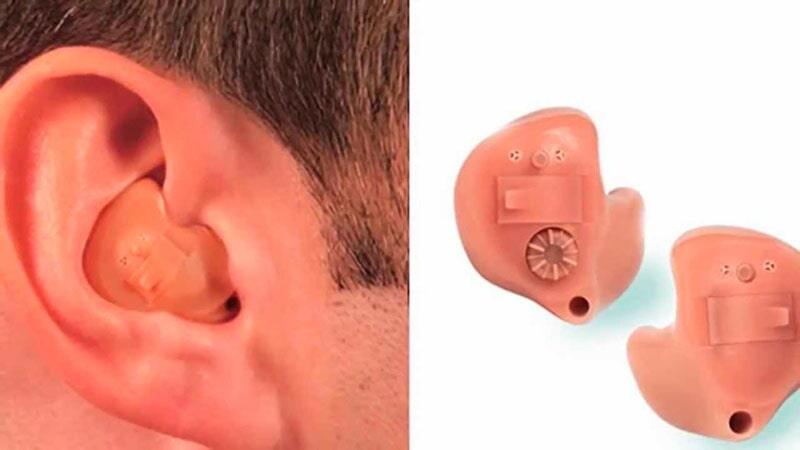 DRA. MARÍA ELENA FLORES MOLINA- audífono phonak