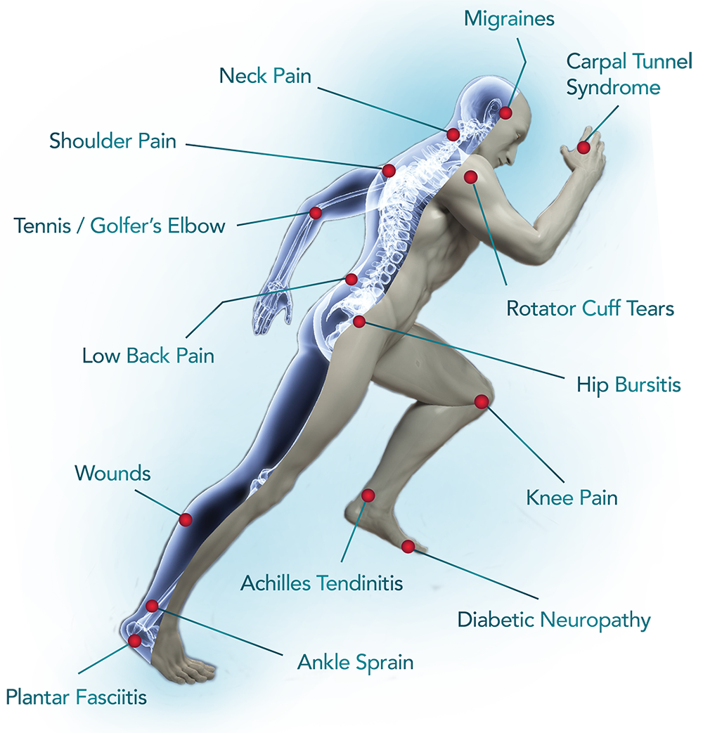 a diagram of a person 's body showing different types of pain