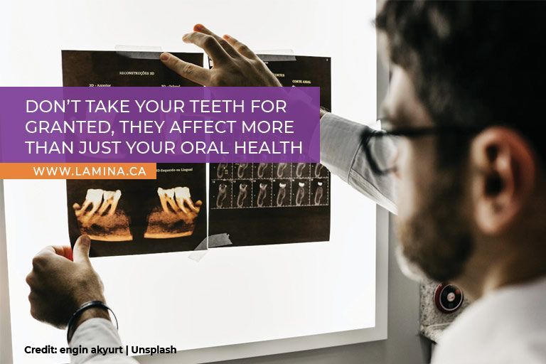 Don’t take your teeth for granted, they affect more than just your oral health