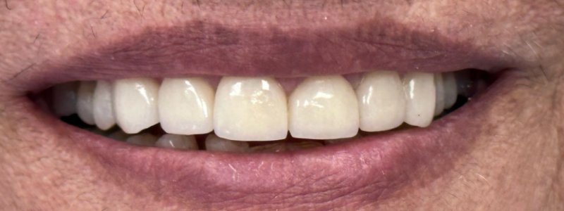 Close-up of a smiling mouth showing white teeth and pink lips