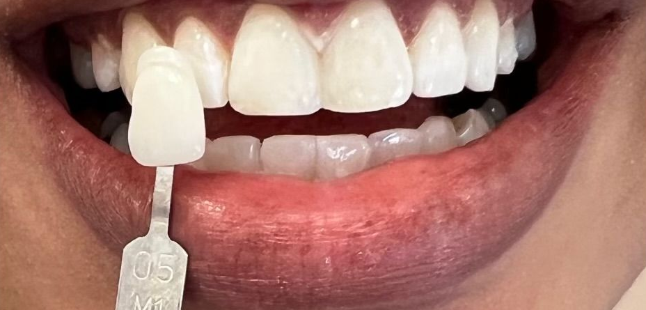 Close-up of a person brushing their front teeth with a white toothbrush.