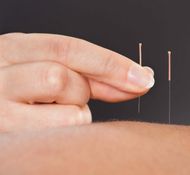 Praktijk Lijfspraak  in balans acupunctuur