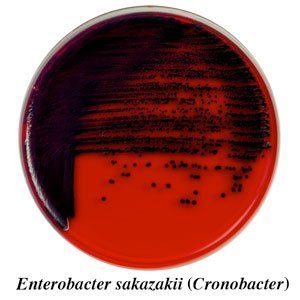 A red and purple plate with the name enterobacter sakazakii on it