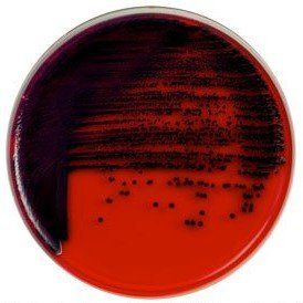 A close up of a red and purple plate with bacteria on it.
