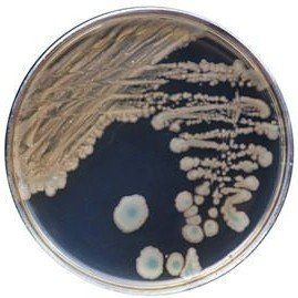A petri dish filled with bacteria on a white background.