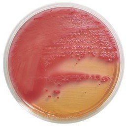 A petri dish filled with red and yellow liquid.